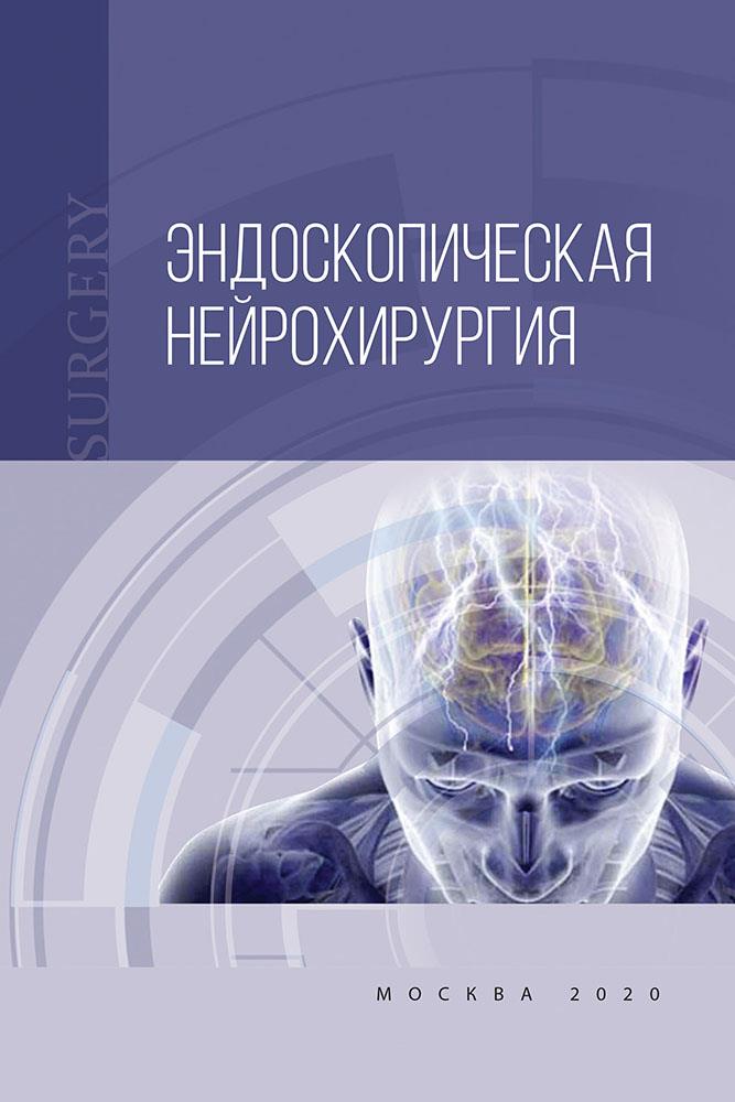 Эндоскопическая нейрохирургия