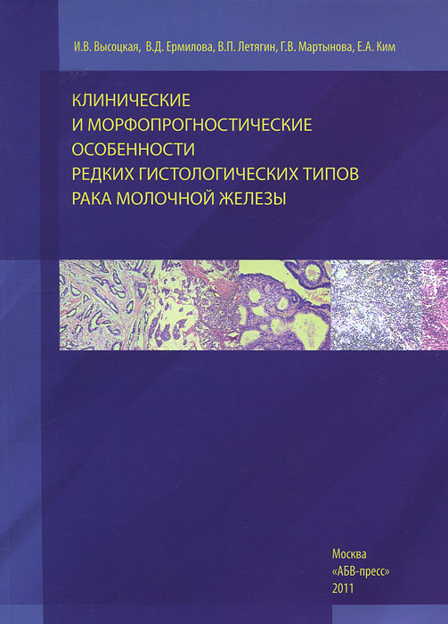 Клинические и морфопрогностические особенности редких гистологических типов рака молочной железы